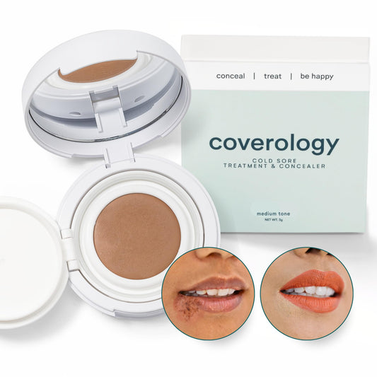 Coverology cold-sore-treatment-concealer-tube with medicated concealer for discreet relief.