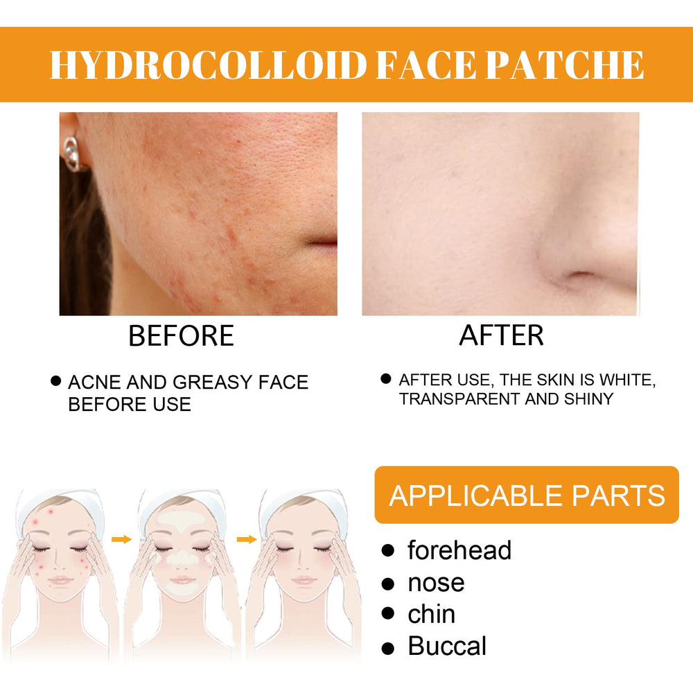 Coweroay cheek patch variant for full-face blemish coverage and texture balance.