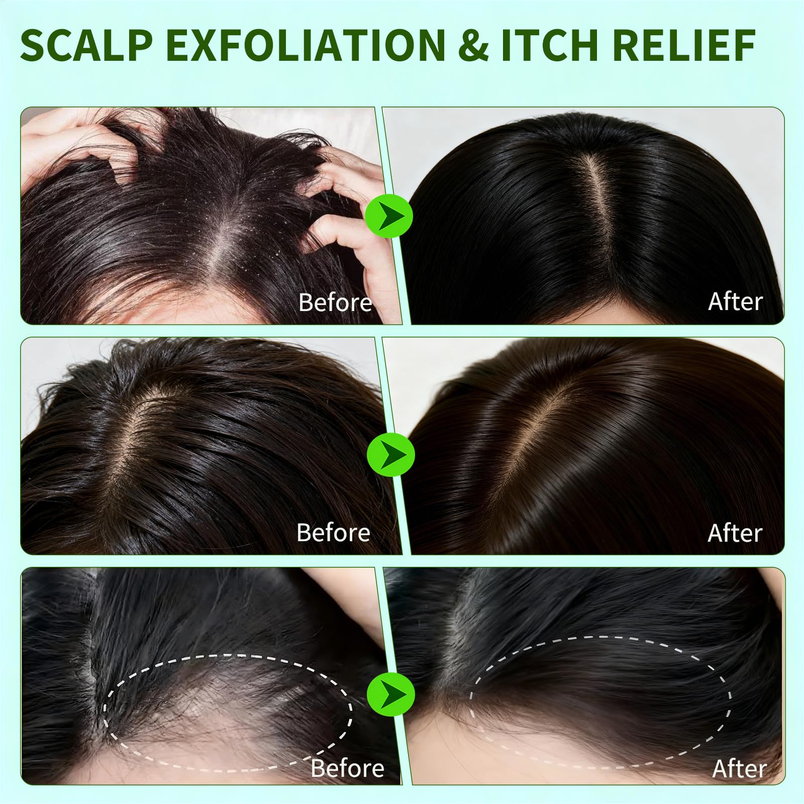 Criszenv Silicone Scalp Massager with soft bristles for even distribution.