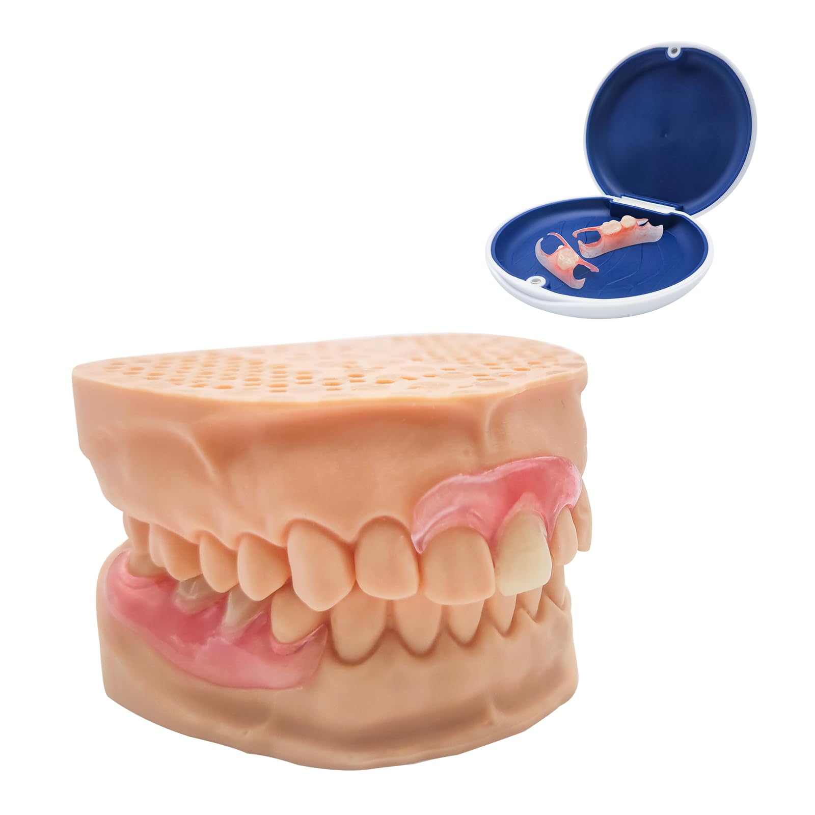 Partial dentures for 6 missing teeth with natural look and comfortable fit