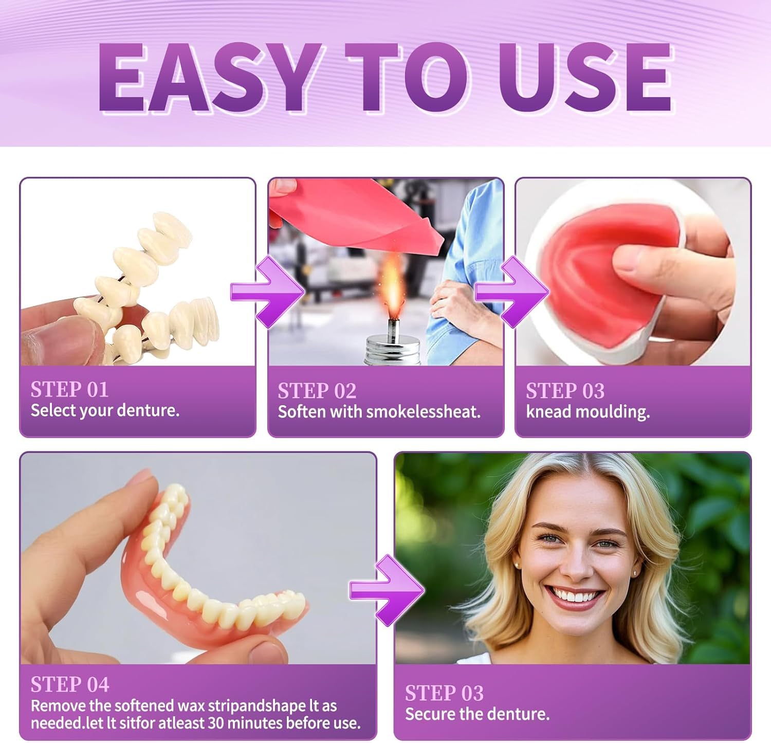 Moldable and reusable denture components for customization
