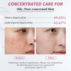 Serum applied to clean skin with lightweight, hydrating feel.