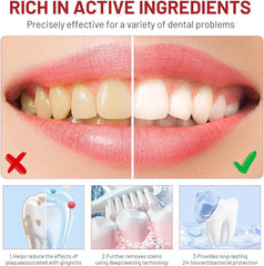 Image illustrating deep cleaning and cavity protection with SP-10 toothpaste