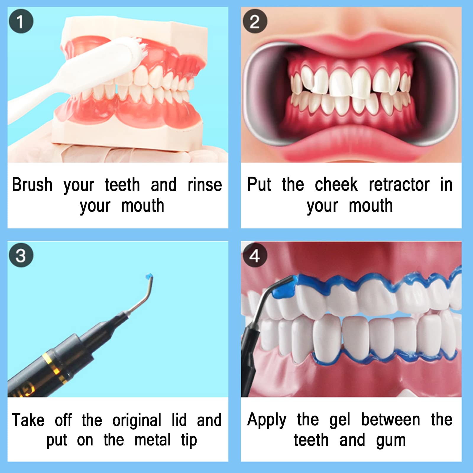 Gum barrier protection gel used during whitening treatment