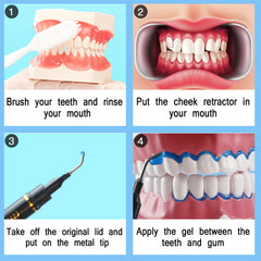 Gum barrier protection gel used during whitening treatment