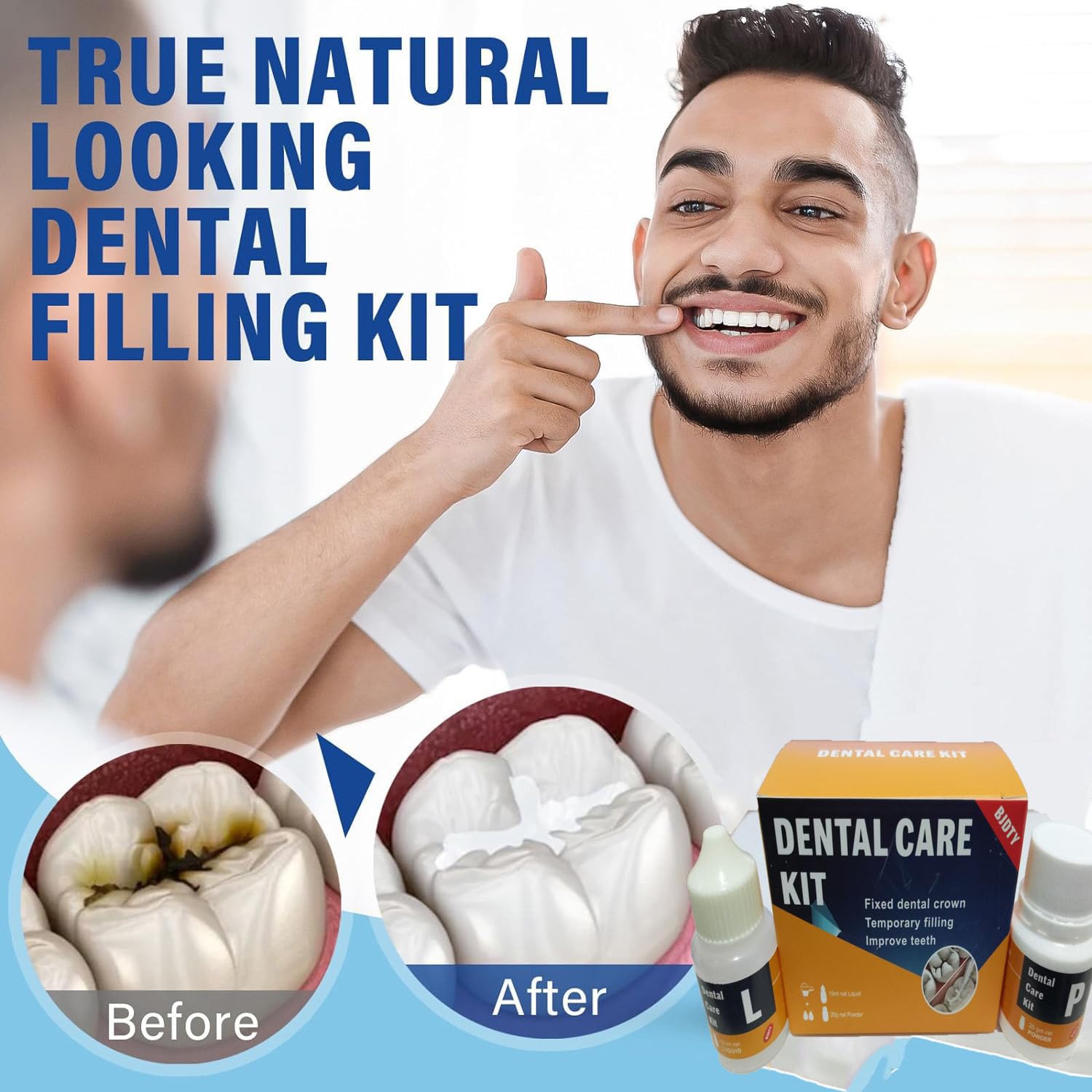 At-home dental repair setup using restoration kit