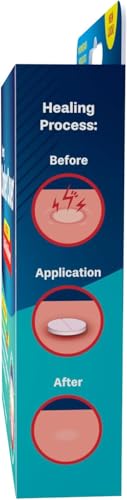 Close-up of mint-flavored canker sore relief tablets