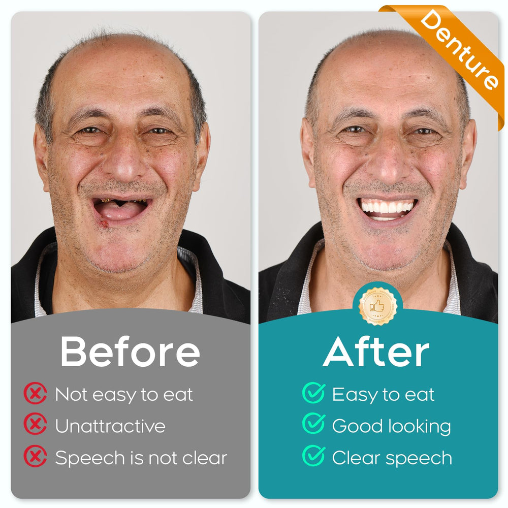 Step-by-step denture assembly and fit process.
