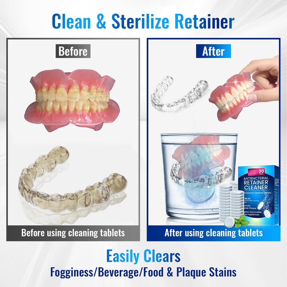 Denture cleaner tablets suitable for ultrasonic cleaners