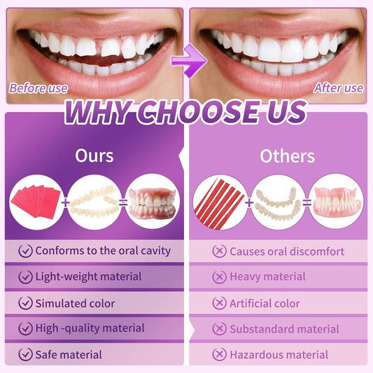 Upper and lower dentures aligned for a DIY smile