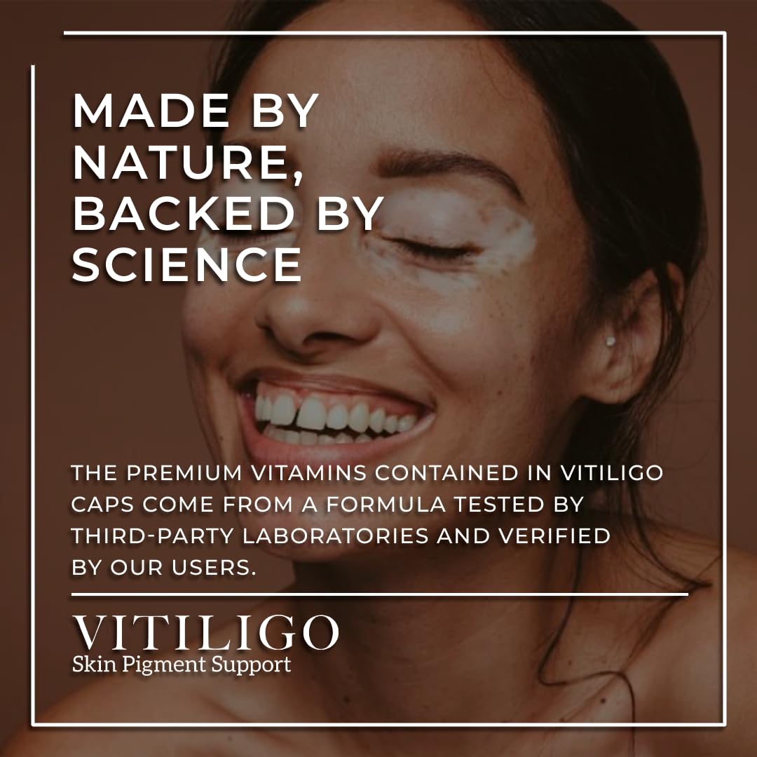 Close-up of Dermawonder Vitiligo Capsules bottle