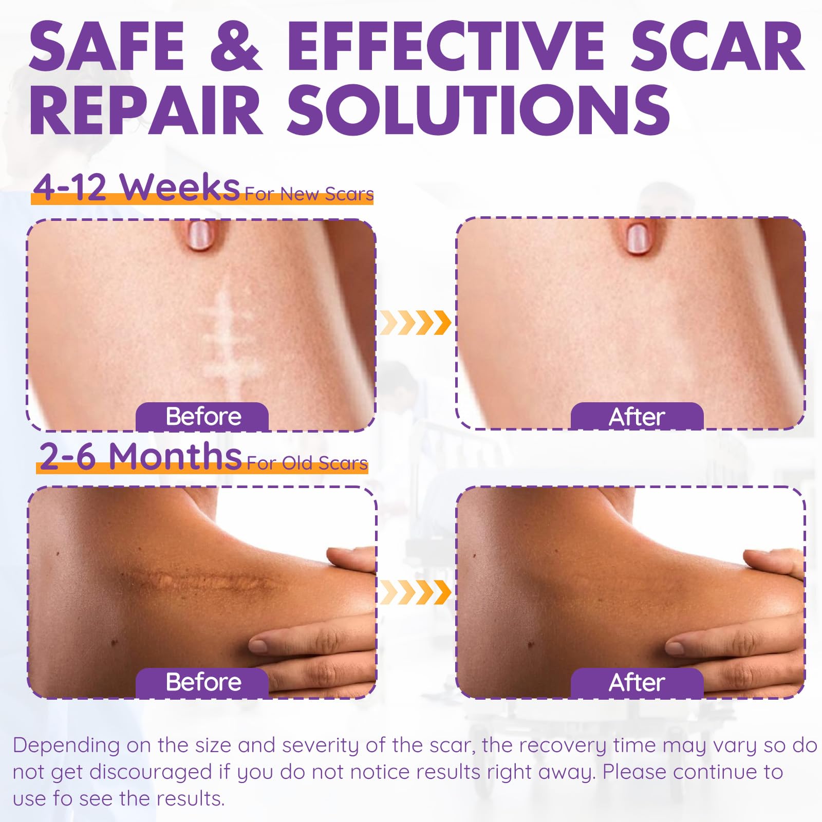 DFK silicone scar sheets pack, reusable and washable for ongoing scar care