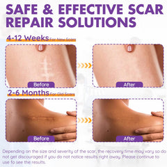 DFK silicone scar sheets pack, reusable and washable for ongoing scar care