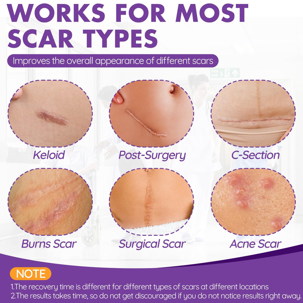 DFK silicone scar tape roll, lightweight and breathable for flexible scar coverage
