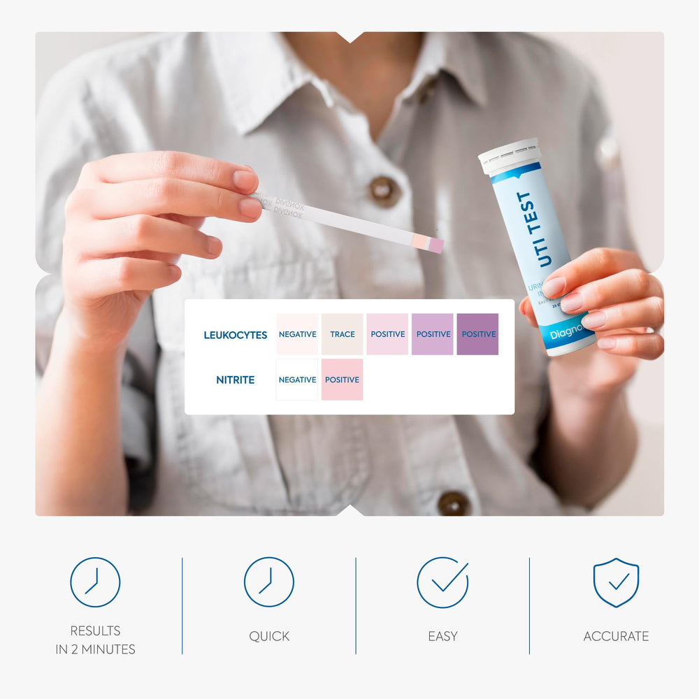 UTI test strips array with color indicator cards