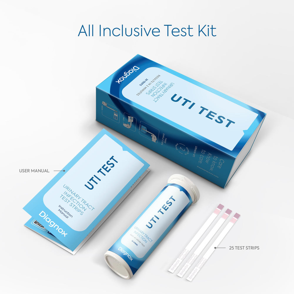 Close-up of a urine test strip showing color results