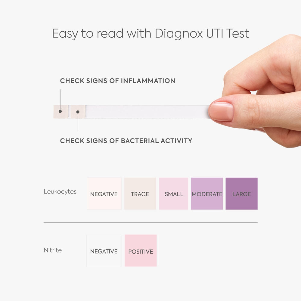 Urinox mobile app interface for tracking test results