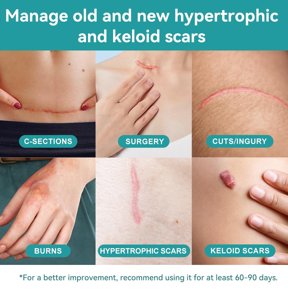 Dimora silicone scar sheet on skin application showing comfortable breathable wear