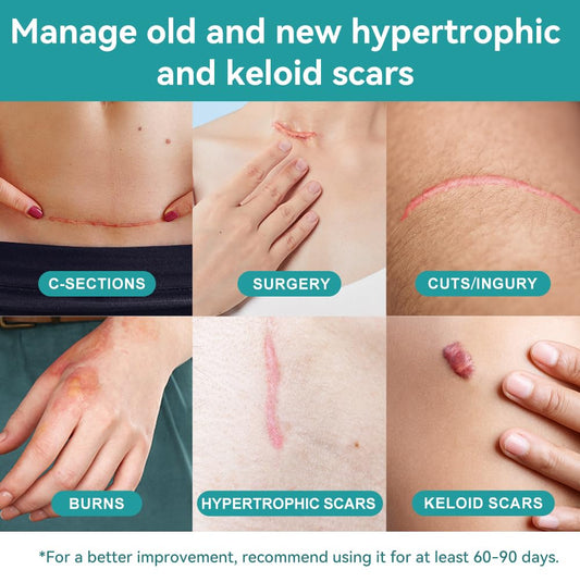 Dimora silicone scar sheet on skin application showing comfortable breathable wear