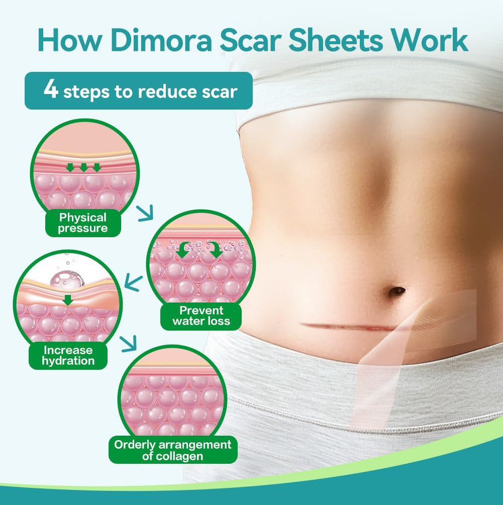 Dimora silicone scar sheets after washing ready to dry and reuse.