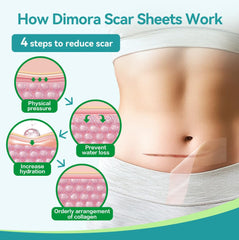 Dimora silicone scar sheets after washing ready to dry and reuse.