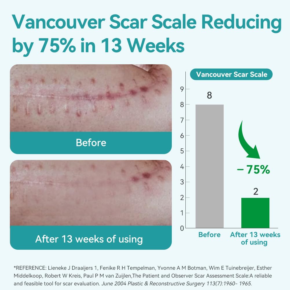 Dimora silicone scar sheets on skin demonstrate comfortable wear for daily activities.
