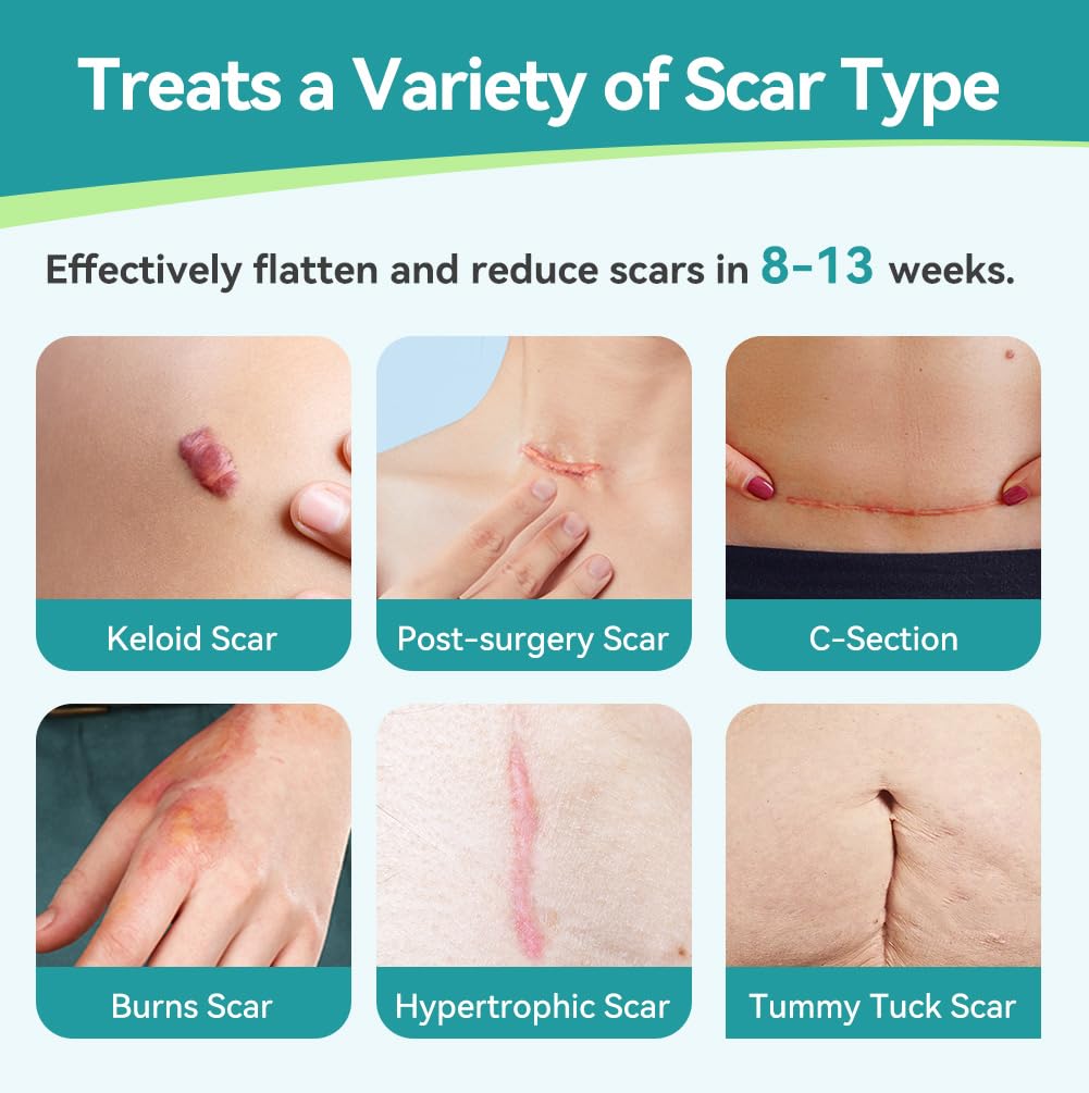 Dimora silicone scar tape close-up highlights hypoallergenic adhesive for sensitive skin.
