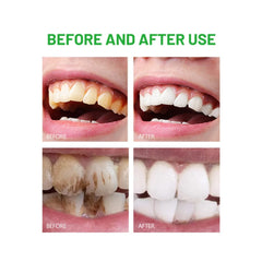 Enamel protection and stronger teeth with minerals