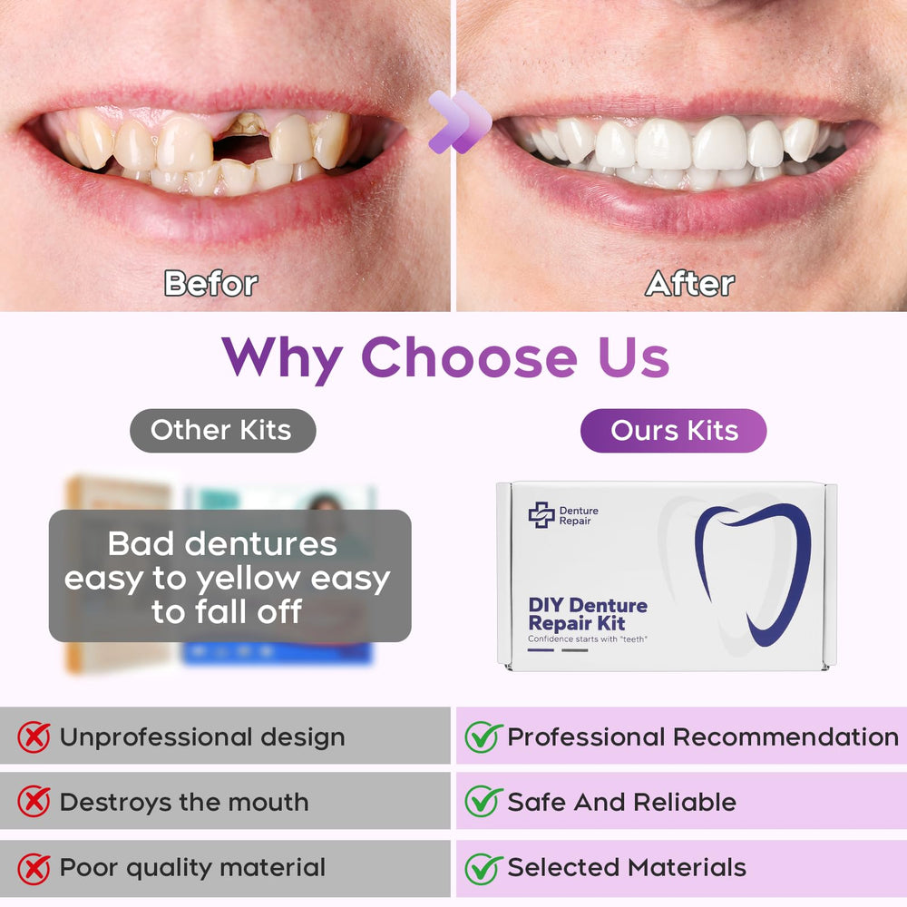 DIY Denture Kit - bottom teeth and fit materials