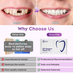DIY Denture Kit - bottom teeth and fit materials