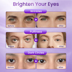 Doracome vitamin E ingredient portrait suggesting nourishment for delicate eye skin