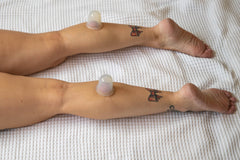 Demonstration of cellulite reduction and skin elasticity benefits from cupping