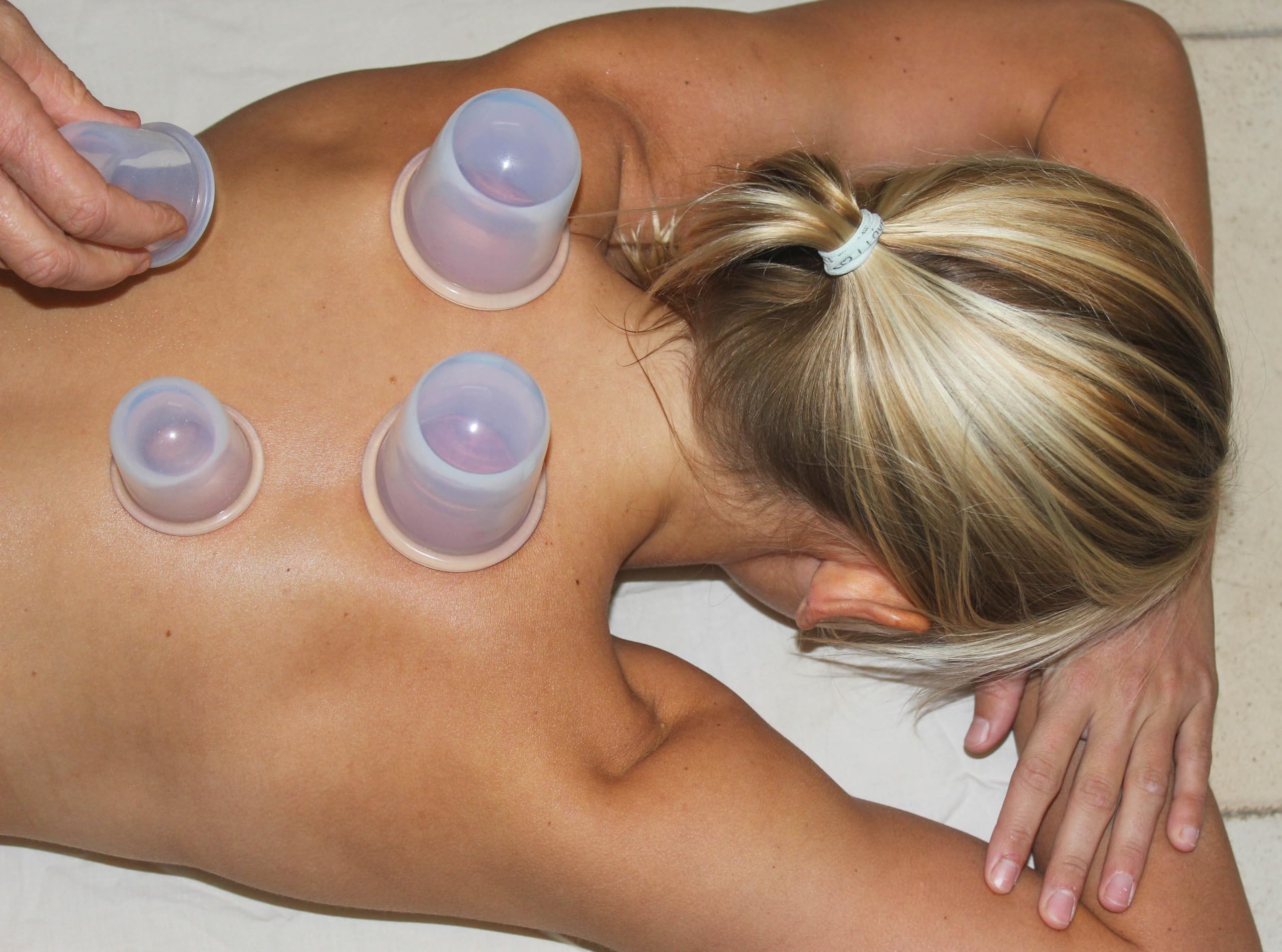 DoSensePro cupping kit used for pain relief on leg
