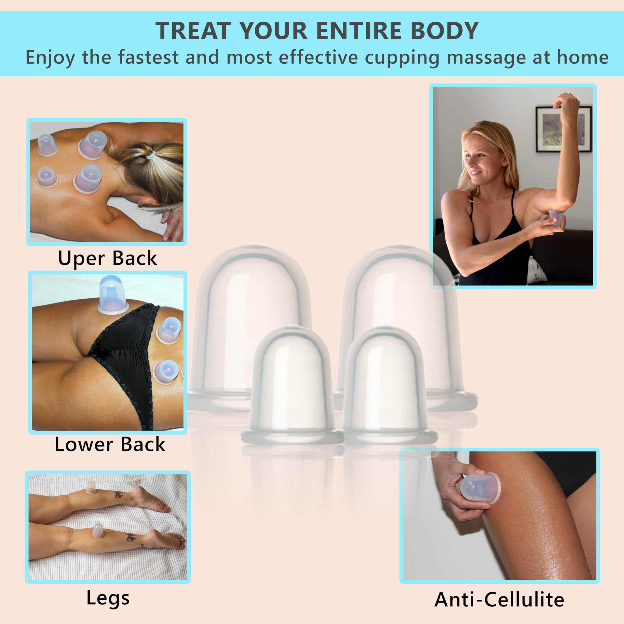 Close-up of XL silicone cups from DoSensePro cupping kit