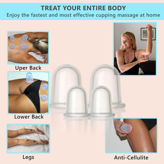 Close-up of XL silicone cups from DoSensePro cupping kit