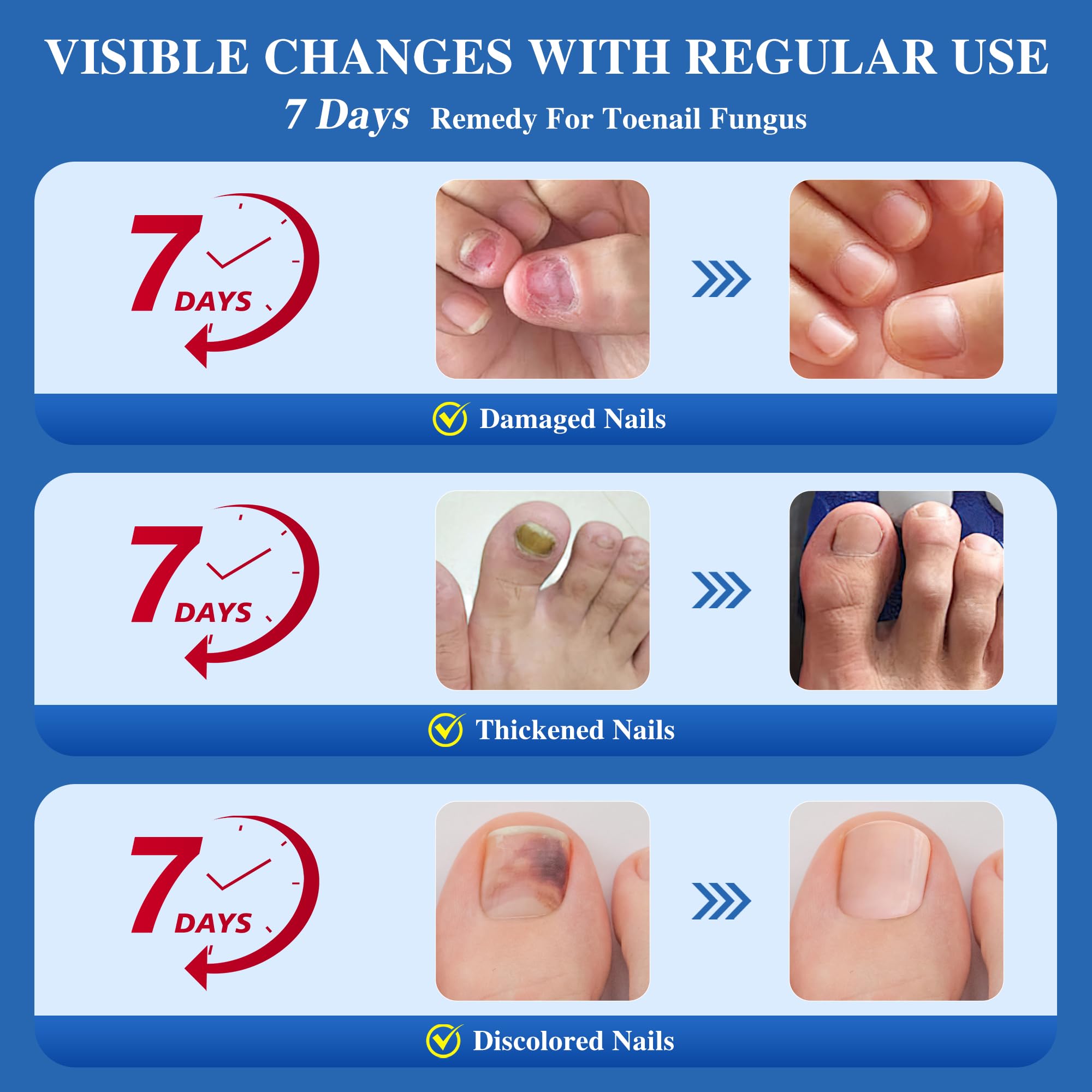 DR.RAPID ingrown nail treatment use demonstrates targeted care