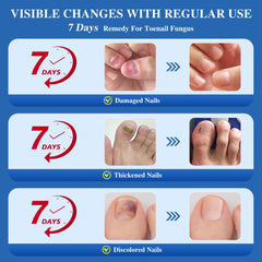 DR.RAPID ingrown nail treatment use demonstrates targeted care