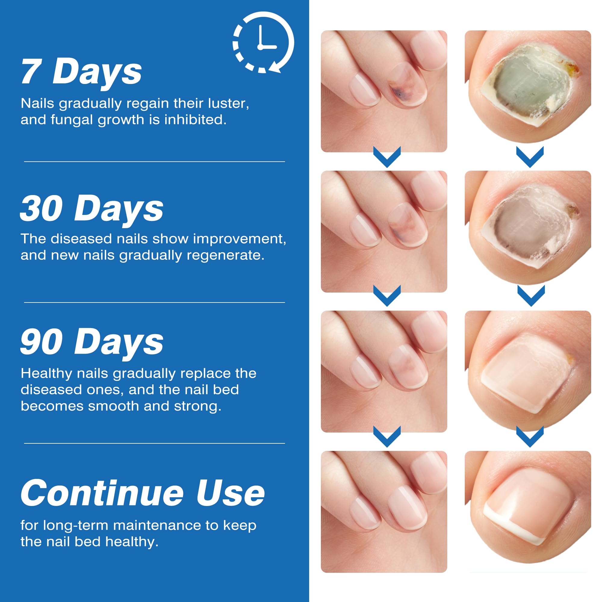 DR.RAPID application-closeup shows precise dosing on affected nails.