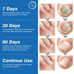 DR.RAPID application-closeup shows precise dosing on affected nails.