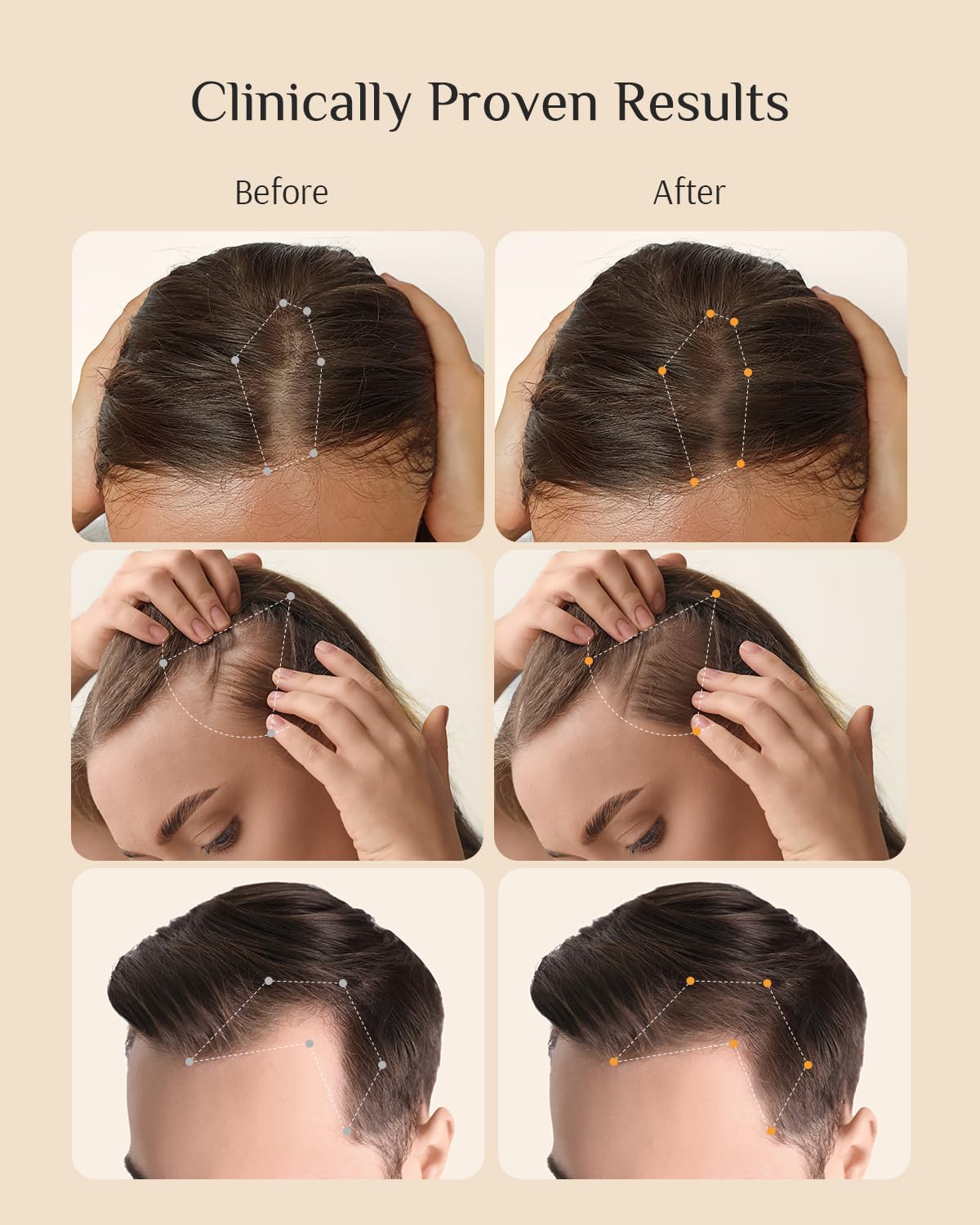 Close-up of DR ZERO label emphasizing Redensyl-powered hair support