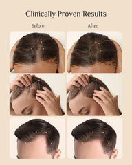 Close-up of DR ZERO label emphasizing Redensyl-powered hair support