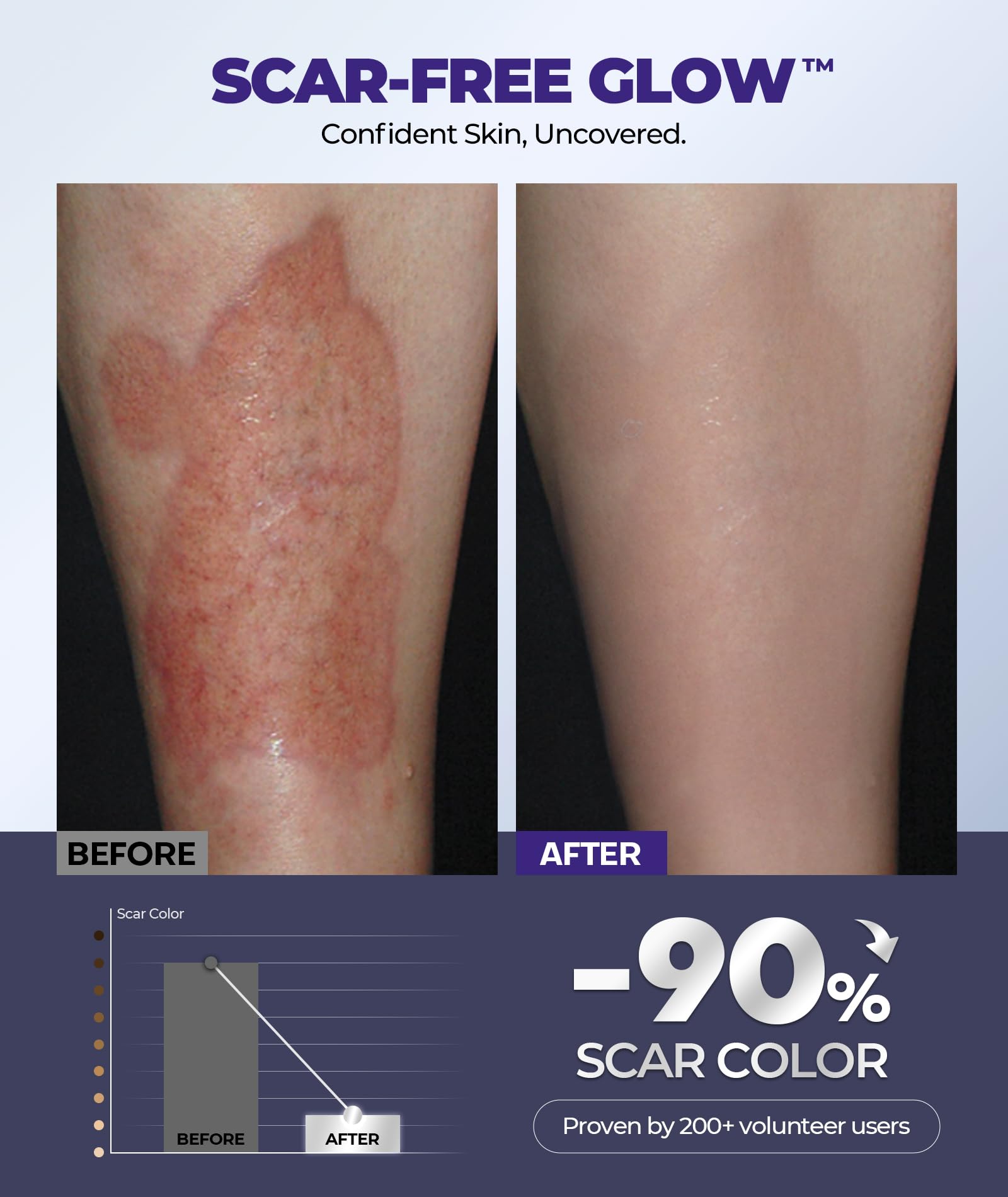 EaseWave scar cream new scar skin visual suggests early improvement potential