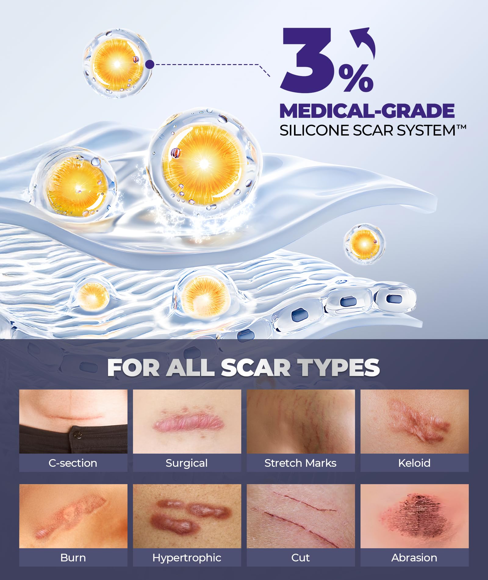 EaseWave scar cream old scar before-after visual hints gradual appearance changes