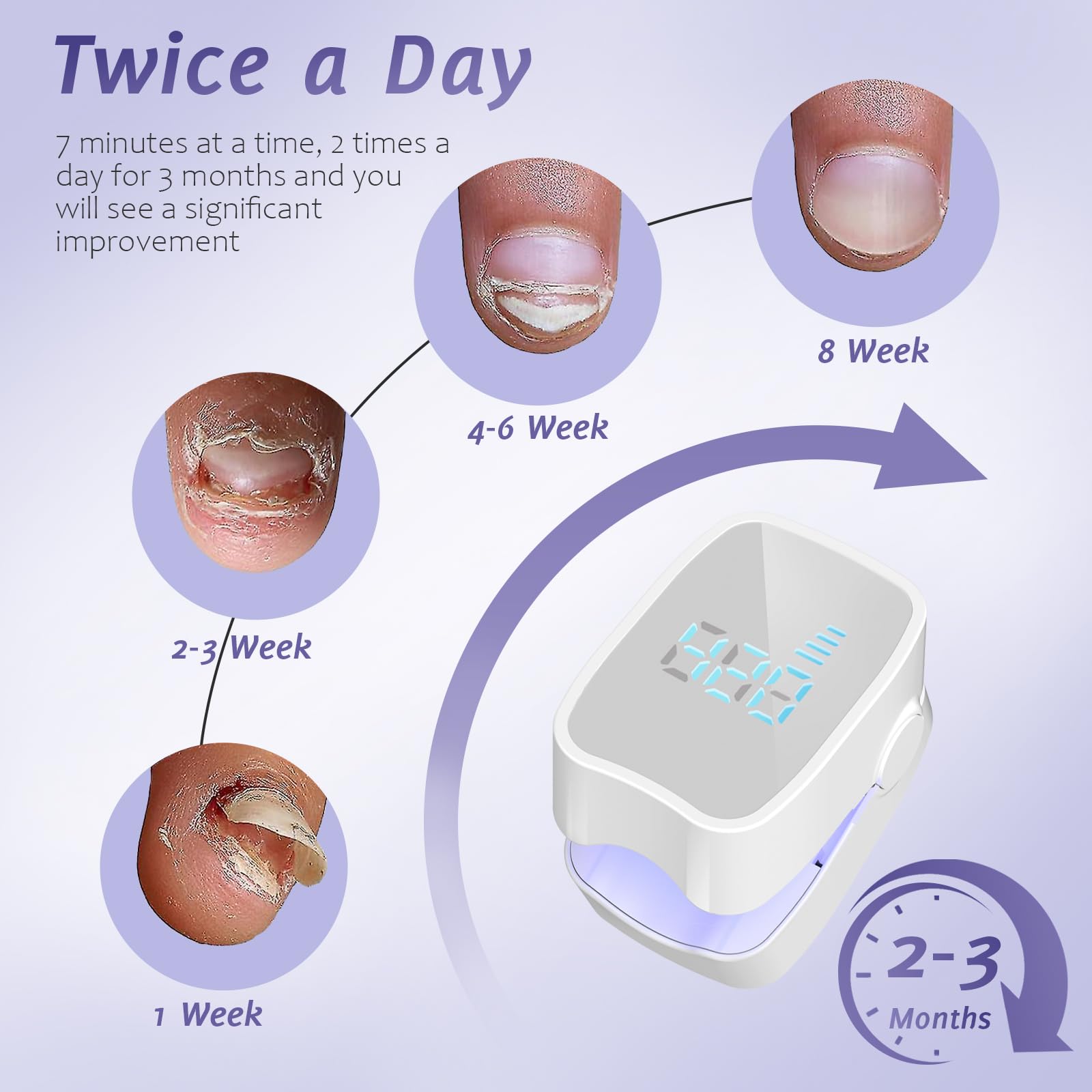 The easheal nail fungus laser device close-up focuses on treated nail area for guidance.