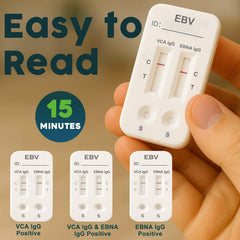 Test result window showing EBV IgG VCA/EBNA readout