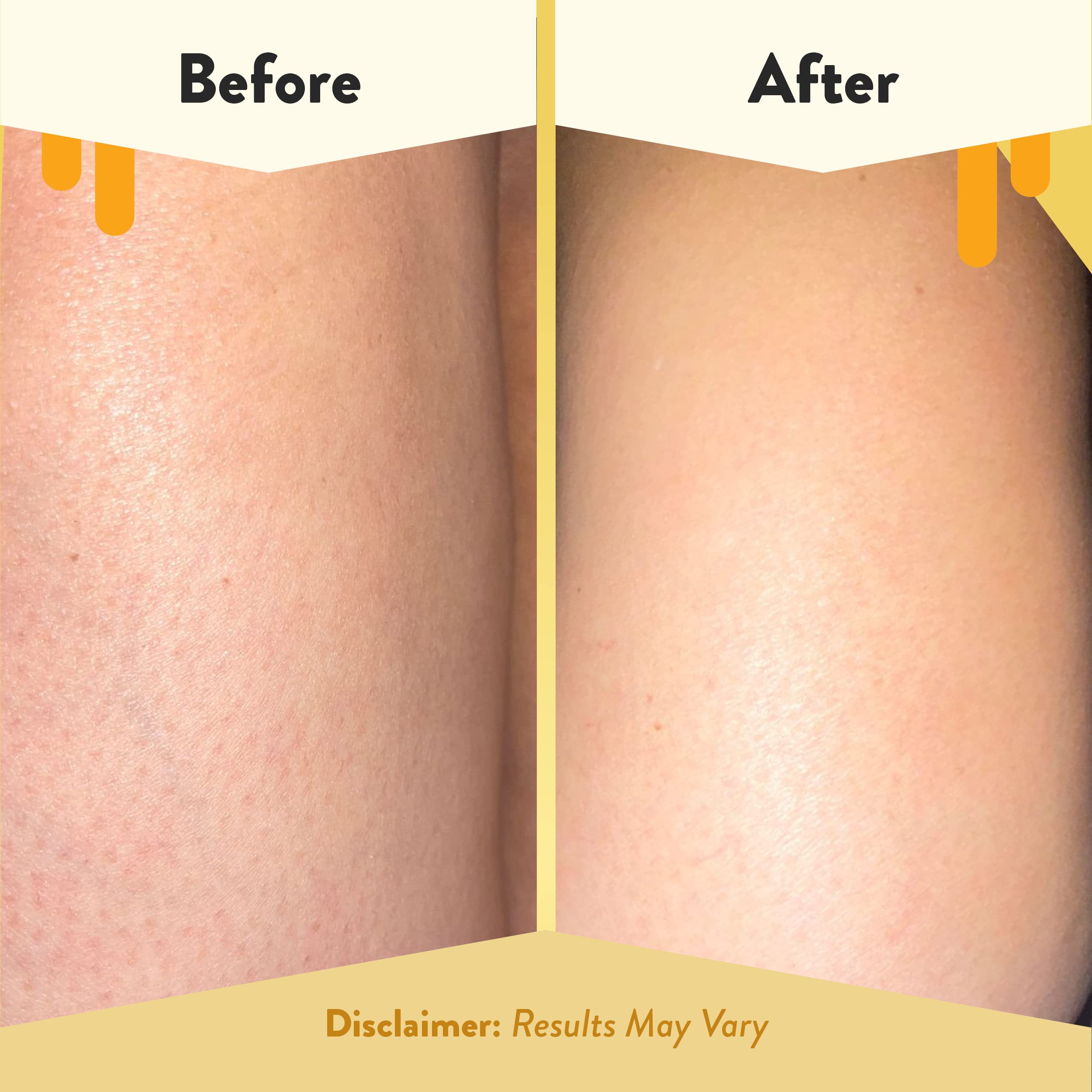 Eczema Honey calendula extract highlights plant-based soothing ingredients.