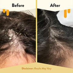 ECZEMA HONEY ingredients-tea-tree-jojoba highlight soothing, nourishing care.