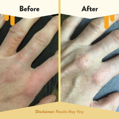 ECZEMA HONEY Oatmeal Hand Cream ingredients like honey and aloe visibly shown