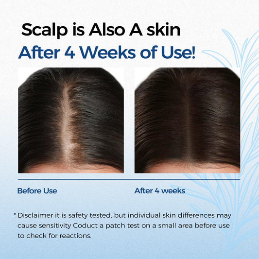 EELEAN roll-on serum applying to thinning areas for scalp care