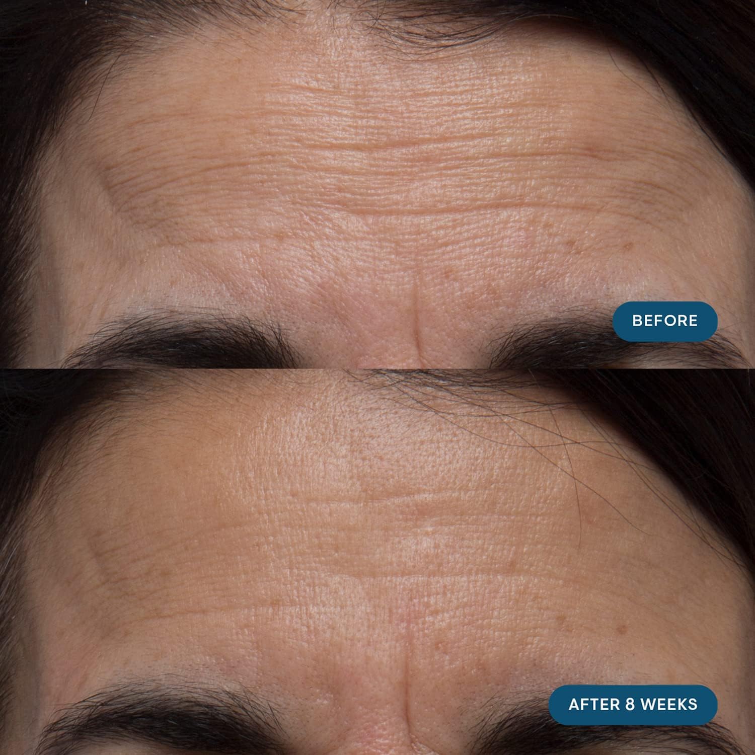 Capsules spilling from a bottle of Pro-Collagen Skin Future